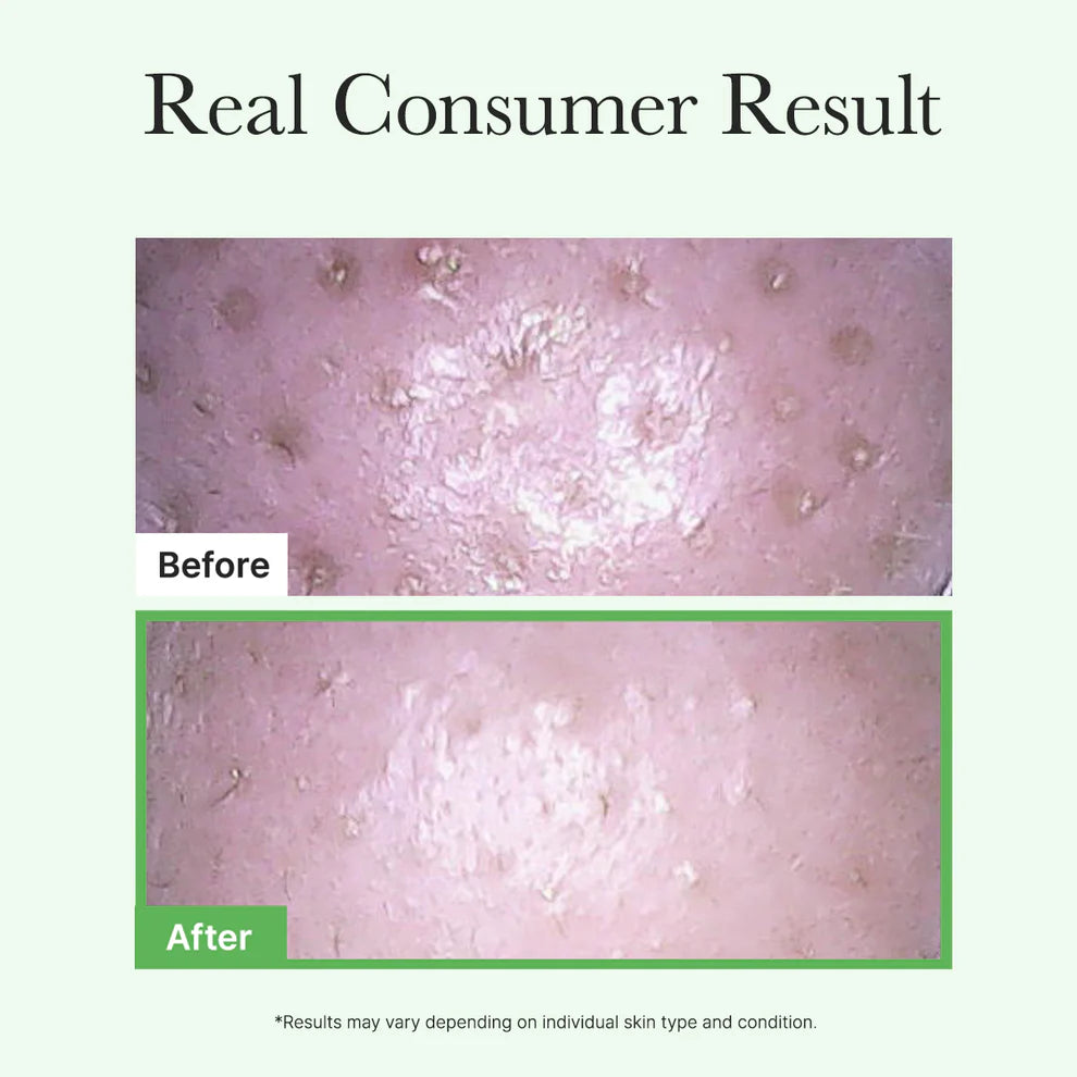 Pore Melt Mochi Makeup-Removing Cleansing Oil 200 ml