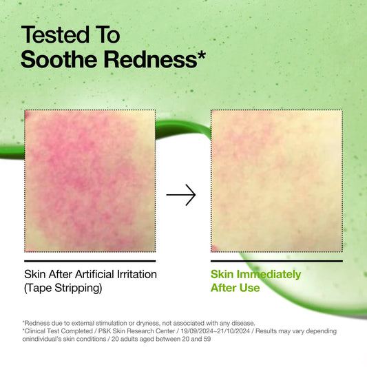 Azelaic Acid 10 Hyaluron Redness Soothing Serum - 30ml