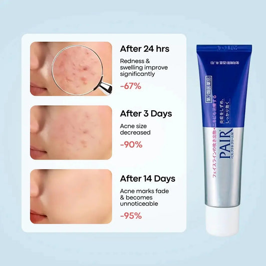 Pair Acne Cream W 24g
