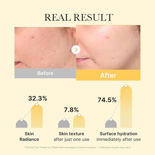 Kojic Acid Turmeric Gel Mask