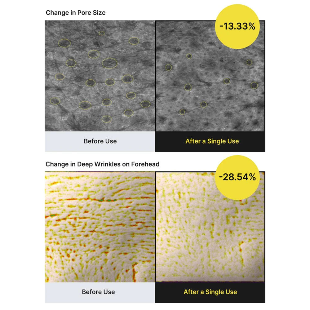 The Vita A Retinal Shot Tightening Booster