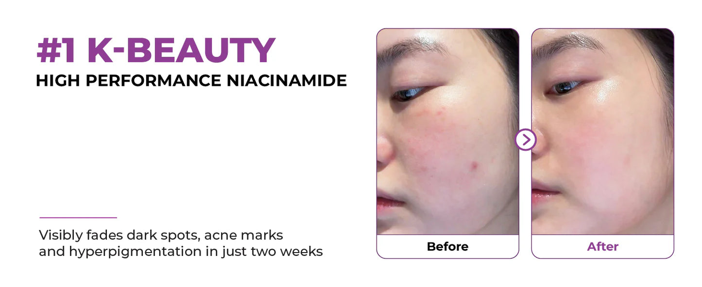 Niacinamide 20 Serum 40ml